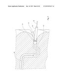 A SEALING DEVICE FOR COLONOSCOPY PROCEDURE diagram and image