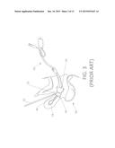 Intracorporeal Transilluminator of Tissue Using Led Array diagram and image