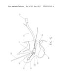 Intracorporeal Transilluminator of Tissue Using Led Array diagram and image