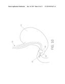 Intracorporeal Transilluminator of Tissue Using Led Array diagram and image