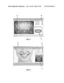 Procedure for dental aesthetic analysis of the smile area and for     facilitating the identification of dental aesthetic treatments diagram and image