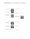 Procedure for dental aesthetic analysis of the smile area and for     facilitating the identification of dental aesthetic treatments diagram and image