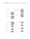 Procedure for dental aesthetic analysis of the smile area and for     facilitating the identification of dental aesthetic treatments diagram and image