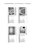 Procedure for dental aesthetic analysis of the smile area and for     facilitating the identification of dental aesthetic treatments diagram and image