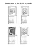 Procedure for dental aesthetic analysis of the smile area and for     facilitating the identification of dental aesthetic treatments diagram and image