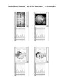 Procedure for dental aesthetic analysis of the smile area and for     facilitating the identification of dental aesthetic treatments diagram and image