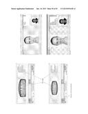 Procedure for dental aesthetic analysis of the smile area and for     facilitating the identification of dental aesthetic treatments diagram and image