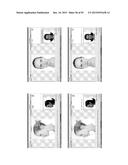 Procedure for dental aesthetic analysis of the smile area and for     facilitating the identification of dental aesthetic treatments diagram and image