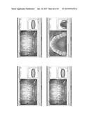 Procedure for dental aesthetic analysis of the smile area and for     facilitating the identification of dental aesthetic treatments diagram and image