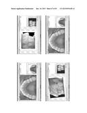 Procedure for dental aesthetic analysis of the smile area and for     facilitating the identification of dental aesthetic treatments diagram and image