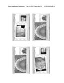 Procedure for dental aesthetic analysis of the smile area and for     facilitating the identification of dental aesthetic treatments diagram and image