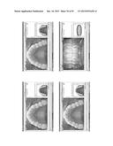 Procedure for dental aesthetic analysis of the smile area and for     facilitating the identification of dental aesthetic treatments diagram and image