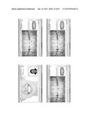 Procedure for dental aesthetic analysis of the smile area and for     facilitating the identification of dental aesthetic treatments diagram and image