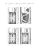 Procedure for dental aesthetic analysis of the smile area and for     facilitating the identification of dental aesthetic treatments diagram and image