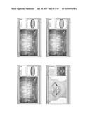 Procedure for dental aesthetic analysis of the smile area and for     facilitating the identification of dental aesthetic treatments diagram and image