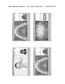 Procedure for dental aesthetic analysis of the smile area and for     facilitating the identification of dental aesthetic treatments diagram and image