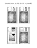 Procedure for dental aesthetic analysis of the smile area and for     facilitating the identification of dental aesthetic treatments diagram and image