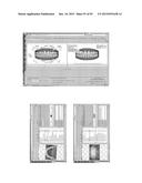 Procedure for dental aesthetic analysis of the smile area and for     facilitating the identification of dental aesthetic treatments diagram and image