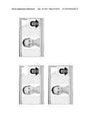 Procedure for dental aesthetic analysis of the smile area and for     facilitating the identification of dental aesthetic treatments diagram and image