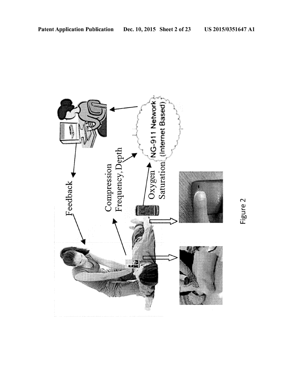 EFFECTIVE CPR PROCEDURE WITH REAL TIME EVALUATION AND FEEDBACK USING     SMARTPHONES - diagram, schematic, and image 03