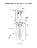 Automatic Air Management System diagram and image