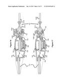 Automatic Air Management System diagram and image