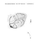 Linear Multi-Domain Electrocardiogram diagram and image