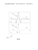 Linear Multi-Domain Electrocardiogram diagram and image