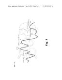 Method And System For Monitoring Depth Of Anaesthesia And Sensory     Functioning diagram and image