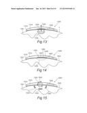 MODULAR PHYSIOLOGIC MONITORING SYSTEMS, KITS, AND METHODS diagram and image