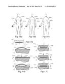 MODULAR PHYSIOLOGIC MONITORING SYSTEMS, KITS, AND METHODS diagram and image