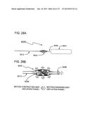 METHODS AND DEVICES TO DECREASE TISSUE TRAUMA DURING SURGERY diagram and image