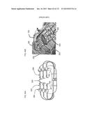 METHODS AND DEVICES TO DECREASE TISSUE TRAUMA DURING SURGERY diagram and image