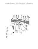 METHODS AND DEVICES TO DECREASE TISSUE TRAUMA DURING SURGERY diagram and image