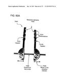 METHODS AND DEVICES TO DECREASE TISSUE TRAUMA DURING SURGERY diagram and image