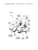 METHODS AND DEVICES TO DECREASE TISSUE TRAUMA DURING SURGERY diagram and image