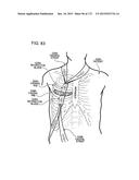 METHODS AND DEVICES TO DECREASE TISSUE TRAUMA DURING SURGERY diagram and image