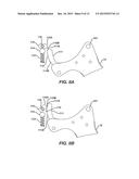 Jawed Receiver for Needle Cartridge diagram and image