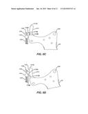 Articulation Control for Surgical Instruments diagram and image