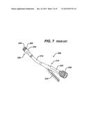 Methods and Devices for Reinforcing a Staple Line diagram and image