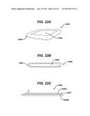 Methods and Devices for Reinforcing a Staple Line diagram and image