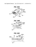 Methods and Devices for Reinforcing a Staple Line diagram and image