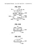 Methods and Devices for Reinforcing a Staple Line diagram and image