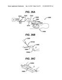 Methods and Devices for Reinforcing a Staple Line diagram and image