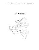 Woven and Fibrous Materials for Reinforcing a Staple Line diagram and image