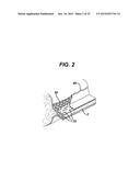 Woven and Fibrous Materials for Reinforcing a Staple Line diagram and image