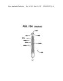 Woven and Fibrous Materials for Reinforcing a Staple Line diagram and image