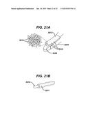 Woven and Fibrous Materials for Reinforcing a Staple Line diagram and image