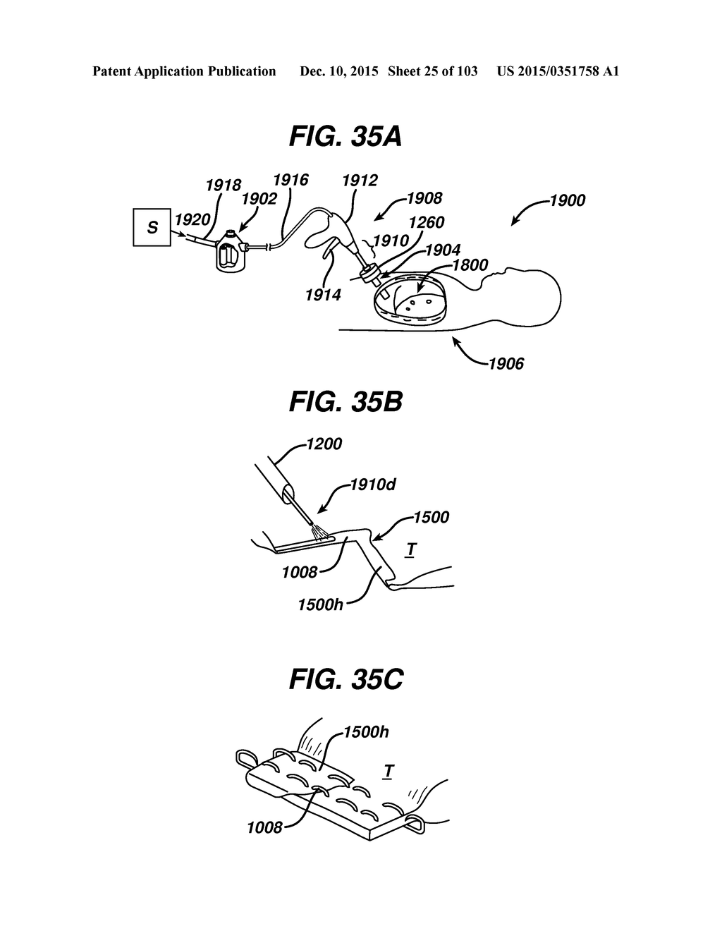 ADJUNCT MATERIALS AND METHODS OF USING SAME IN SURGICAL METHODS FOR TISSUE     SEALING - diagram, schematic, and image 26