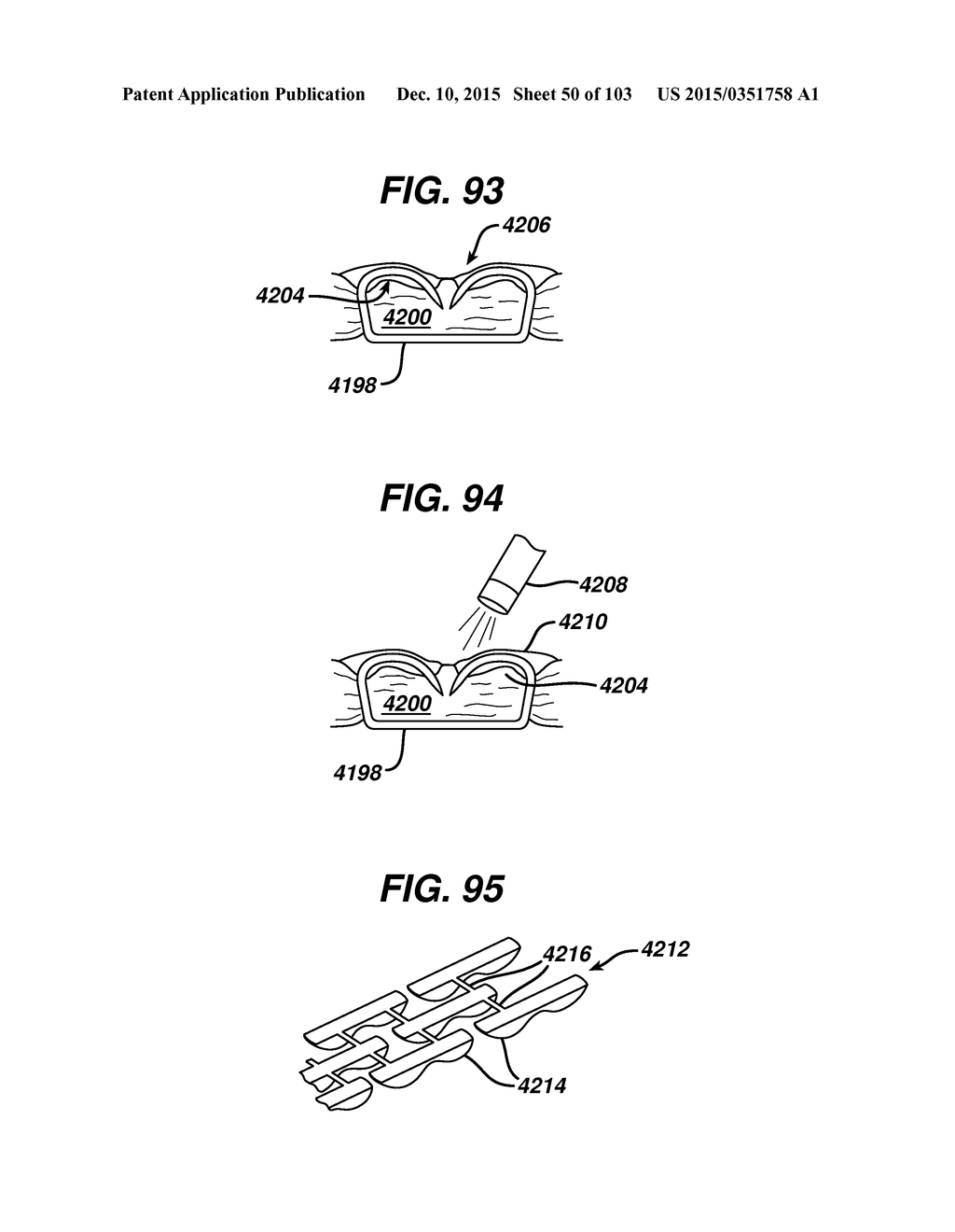 ADJUNCT MATERIALS AND METHODS OF USING SAME IN SURGICAL METHODS FOR TISSUE     SEALING - diagram, schematic, and image 51